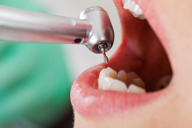 Best Emergency Treatment for Toothache in Crossville, AL